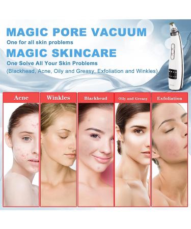 2023 Tunbot Blackhead Remover Vacuum Cleaner - Rechargeable Facial Extractor Tool with 5 Suction Power & Probes for Acne-Prone, Oily, Dry Skin - Buy Online on GoSupps.com