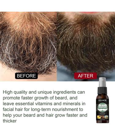 Taomenger Derma Scooter for Men - Ultimate Beard Growth Kit | Moisturizing Beard Care Essence & Stimulating Growth Liquid - Perfect Gifts for Men - Buy Online on GoSupps.com