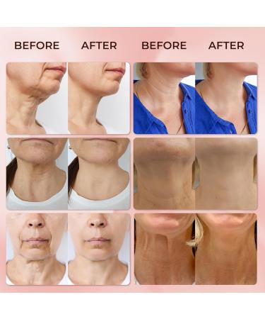 ABERA Loka Nano Collagen Neck Cream SPF 30+ | Anti-Aging Neck & D collet Treatment with Niacinamide | Firming & Tightening Moisturizer for Women (1.76 Fl Oz - Buy Online on GoSupps.com