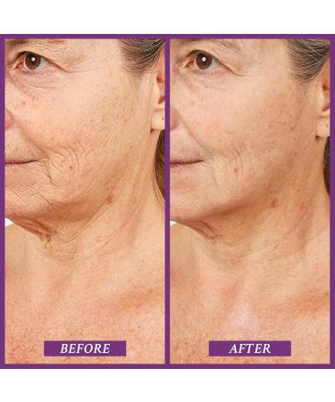 Prai Beauty Ageless Neck & D collet Serum 120ml | Anti-Aging Firing Serum for Wrinkle Reduction & Skin Tone Improvement - Buy Online on GoSupps.com