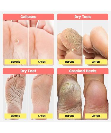 Exfoliating Foot Peel Mask by Bright Nour | For Men and Women | Natural Ingredients | Softens Cracked Heels, Dry Skin & Calluses | Spa Care at Home - Buy Online on GoSupps.com