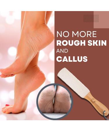 Eco Bath London Natural White Pumice Foot File - Dead Skin Remover for Feet with Wood Handle - Buy Online on GoSupps.com