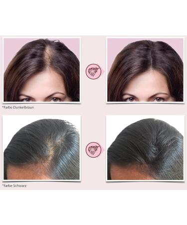 Fully Skull Spread Hair for Women - 27g Black Hair Fibers for Thin Hair & Hair Loss - Thickening Hair Solution - Buy Online on GoSupps.com