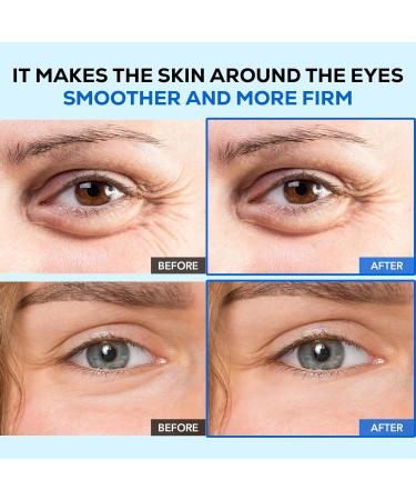 Olivia & Allison AQUA-H WRINKLE CORRECTOR EYE CARE - Adenosine + Hyaluronic Acid for Smoother & Youthful Eyes - Buy Online on GoSupps.com