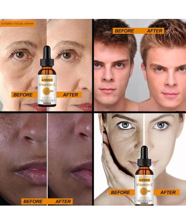 Vitamin C Serum with Hyaluronic Acid Retinol & Niacinamide Anti-Aging Reduce Fine Lines Dark Spots & Brighten Skin (1 oz - Buy Online on GoSupps.com