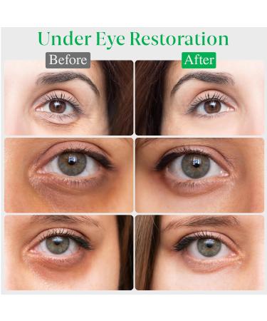 EyeGLO Caffeine Eye Cream | Dark Circles & Puffiness Treatment | Peptides Antioxidants & Hyaluronic Acid - 1 Oz - Buy Online on GoSupps.com