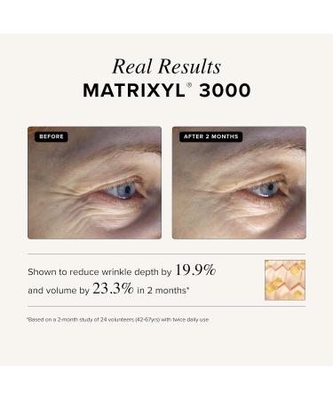 Asterwood Matrixyl 3000 + Argireline Serum for Face - Multi Peptide Serum with Hyaluronic Acid - Anti-Aging Wrinkle Reducing Collagen Boosting - Fragrance-Free - 1 Fl Oz 1 Fl Oz (Pack of 1) - Buy Online on GoSupps.com