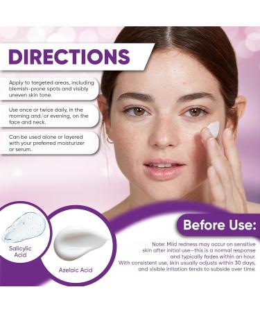 Azelaic Acid Cream for Face: Redness-Soothing Azelaic Acid Facial Cream for Uneven Tone, Blemish-Prone Skin, Pore Care and Skin Clarity Support, 1 oz 1 Fl Oz (Pack of 1) - Buy Online on GoSupps.com