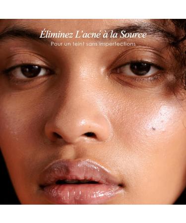 Project E Beauty D'arsonval High Frequency Wand Argon Gas | Purple Violet Beauty Skin Care Acne Spot Pimple Removal Remover Skin Face Tightening Lifting Puffy Eyes Therapy Facial Portable Device - Buy Online on GoSupps.com