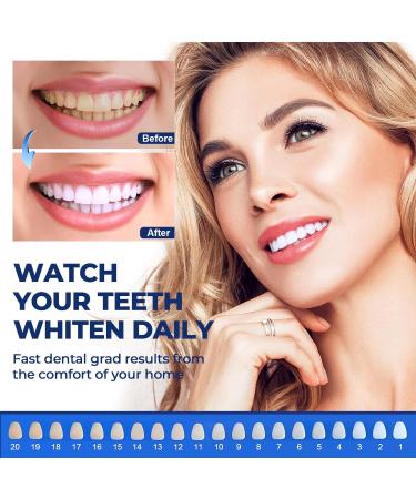 Celakeety Teeth Whitening Kit: Pap Teeth Whitener for Sensitive Teeth- Professional Tooth Whitening Kit Dental Tools with Mouth Tray 6 Teeth Whitening Gels 2 Desensitizing Gels and Storage Case - Buy Online on GoSupps.com