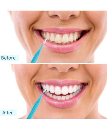 100 Pieces Interdental Braces Brush Set for Oral Hygiene - Light Blue/Grey/Purple - Buy Online on GoSupps.com
