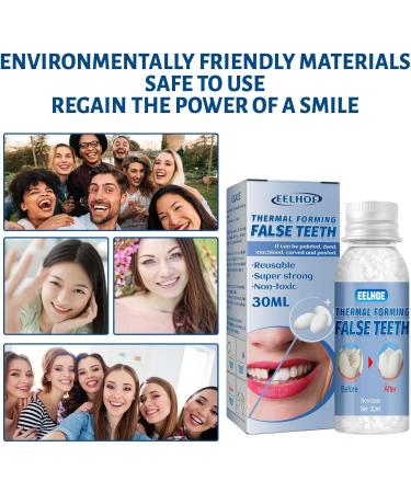 Kings Temporary Tooth Repair 40g - Thermal Operlen Tooth Filling & Temporary Veneer for Broken Tooth Fixing - Buy Online on GoSupps.com