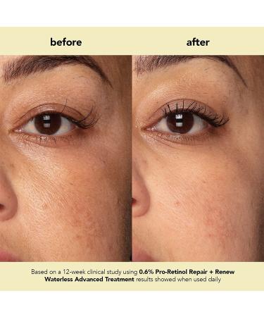 boscia 0.6% Pro-Retinol Repair + Renew Waterless Advanced Treatment - Vegan Cruelty-Free Natural Skin Care - For Fine Lines & Wrinkles - 1 fl oz 1 Fl Oz (Pack of 1) Clear - Buy Online on GoSupps.com