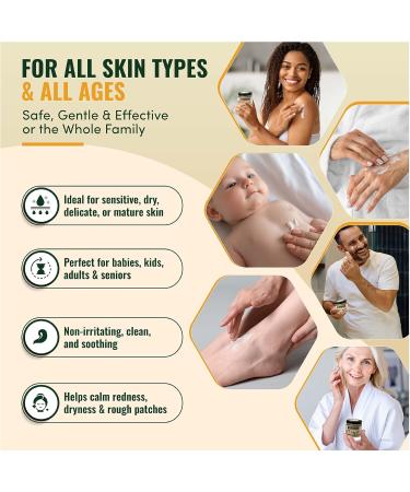 Natural Organic Tallow Balm For Skin That Rejects Synthetic Lotion - Handmade Beef Tallow and Manuka Honey Balm Face Moisturizer for Dry Cracked Hands and Aging Skin - Award Winning - Buy Online on GoSupps.com
