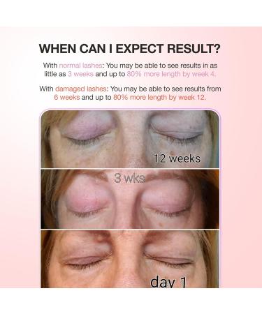 Curacoro 3x Growth Serum - Lash Extension & Eyelash Enhancer for Fuller Longer Lashes - Peptide Serum for Natural Lashes & Eyebrows (5ml) - Fast International Shipping - Buy Online on GoSupps.com