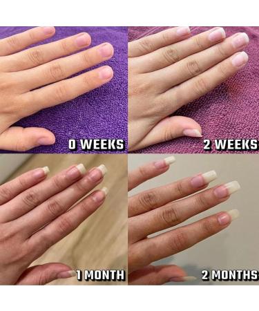 Radiant Nail Growth Oil - Strengthening & Moisturizing Serum | 6PCs Cosmetic Nail Treatment for Healthy Lightened Nails - Buy Online on GoSupps.com