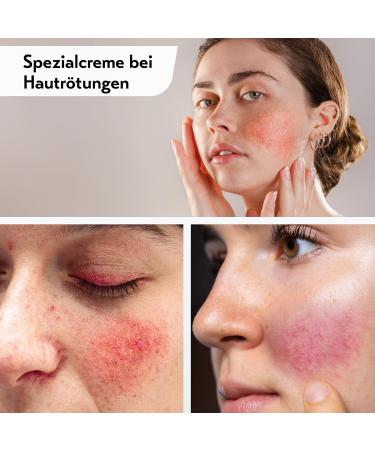 Deruba Special Cream for Redness with SPF 50+ | Expert-Developed Facial Care Makeup & Sun Protection - 30 ml - Buy Online on GoSupps.com