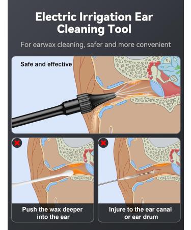 Electric Ear Wax Removal Kit | AOPICK Ear Cleaner with 4 Pressure Settings | 10 Replaceable Tips | Effective Ear Irrigation for Home Use - Buy Online on GoSupps.com
