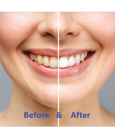 Chomp Super Whitening Cinnamon Toothpaste Tablets with Nano Hydroxyapatite Refill (Pack of 2) 60 Count (Pack of 2) - Buy Online on GoSupps.com