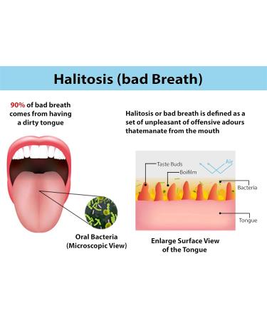 Wonder Care 100% Copper Tongue Scraper - Ayurvedic Antibacterial Oral Hygiene Set (6 Pieces) - Buy Online on GoSupps.com