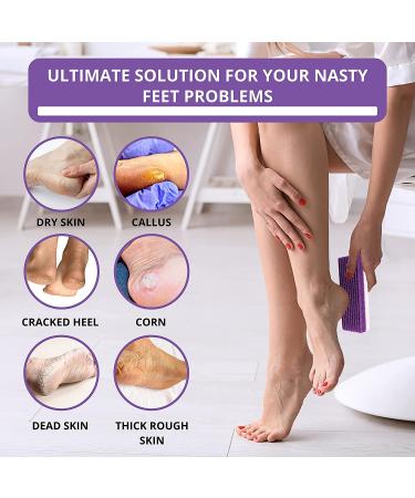 Purple Love Natural Pumice Stone - Professional Exfoliating Rock for Feet, Hands & Body - Dead Skin & Callus Removal - 2-in-1 Scrubber - Buy Online on GoSupps.com