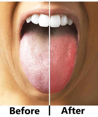 Atmiko Ayurvedic Tongue Scraper, Pack of 2 - Pure Copper Metal Tongue Cleaner for Daily Oral Hygiene | Fresh Breath & Health - Includes Cotton Pouch - Buy Online on GoSupps.com