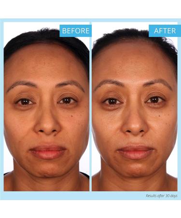 SKINN Luminous Firming Cream - Improve Elasticity, Lift Sagging Skin | Hydrating Vitamin C Formula - Buy Online on GoSupps.com