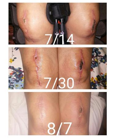 Jenny Joy's Organic Pine Tar Soap Bar - Handmade for Men & Women | Moisturizes & Heals Dry Skin | Natural Woodsy Scent | 5-6 oz - Buy Online on GoSupps.com