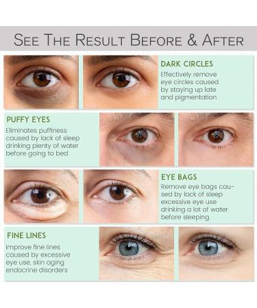 NAZANO Under Eye Patches - 30 Pairs Anti-Aging Collagen & Hyaluronic Acid Masks for Dark Circles, Puffiness & Wrinkles - Buy Online on GoSupps.com