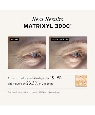 Asterwood Triple Repair Matrixyl 3000 + Argireline + Hyaluronic Acid + Vitamin C Serum for Face - Anti-Aging Collagen Boosting Hydrating - Fragrance-Free - 1 Fl Oz 1 Fl Oz (Pack of 1) Triple Repair - Buy Online on GoSupps.com