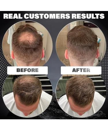 Dark Brown Hair Building Fibers for Men - Conceal Hair Loss  Bald Spots - 100% Natural & Undetectable - 2 Month Supply - Buy Online on GoSupps.com