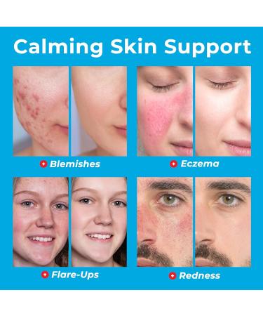 Hypochlorous Acid Spray for Face (8oz Reduces Acne) Targets Bacteria - HOCL Facial Cleanser Acne Spray for Face Body Eczema Pimples Breakouts & Overall Skin Recovery (Reduces Redness) 8 Fl Oz (Pack of 1) - Buy Online on GoSupps.com