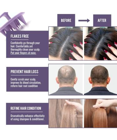 2-Piece Silicone Scalp Massage Brush Set | Mold-Resistant Head Massager for Hair Shampoo - Wakisaki Purple - Buy Online on GoSupps.com