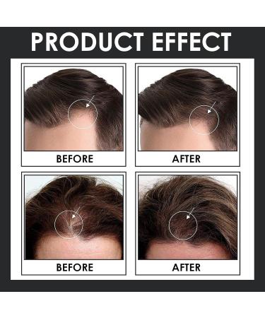 Buy Medium Brown Hair Scatter for Full Dense Look | Hair Compression Solution 27.5g - Buy Online on GoSupps.com