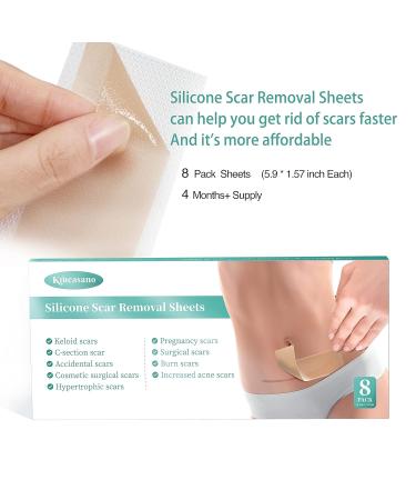 Krucasano Silicone Scar Removal Sheets - 4 Month Supply for Keloid, C-Section, Post-Surgery & Acne Scars - 1.57 x 5.9 - 8 Sheets - Buy Online on GoSupps.com