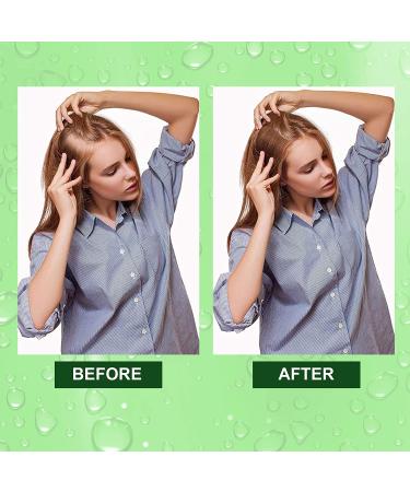 Rosemary Oil for Hair Growth & Skin Care - Stimulates Growth, Improves Scalp Health, 2.02 Fl Oz - Buy Online on GoSupps.com