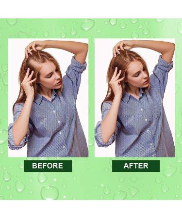 Pure Organic Rosemary Oil for Hair Growth - 2 Fl Oz Serum for Dry, Damaged Hair | Hair Loss Scalp Treatment - Buy Online on GoSupps.com