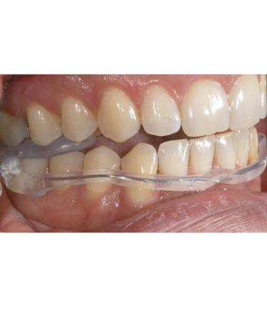 AquaSplint Mini: Self-Adjusting Water-Filled Bite Splint for CMD Relief | International Shipping - Buy Online on GoSupps.com