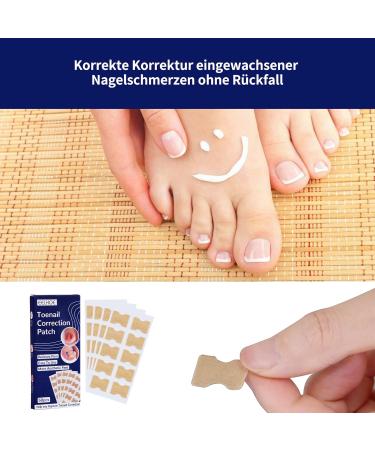 Toenail Patch 50 Pieces Ingrown Toenails Correction Patch Toenail Correction Patch Corrector Pedicure Tools Correction Sticker Toe Nail - Buy Online on GoSupps.com
