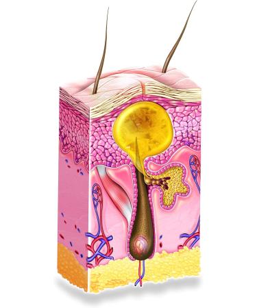 ISISPHARMA TEEN DERM -pure - Severe Anti-Imperfections Treatment - Knotweed Extract Salicylic Acid Avocado Oil Plant Esters - Purifies and Soothes Combination to Oily Skin - Made in France - Buy Online on GoSupps.com