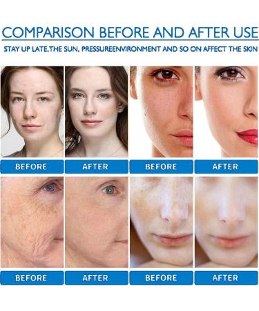 Natural Moisturizing Factors + HA Face Moisturiser & Cream Anti Aging Face Cream Dry Skin Moisturiser with Hydration Formula Anti Redness Cream for Face Facial Moisturiser for Normal to Dry Skin 100ml - Buy Online on GoSupps.com