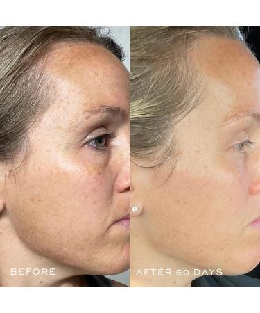 DIME Beauty TBT Serum - Anti-Aging Face Serum With Niacinamide and Mandelic Acid Hydrating for Youthful Skin 1 oz (30 mL) - Buy Online on GoSupps.com