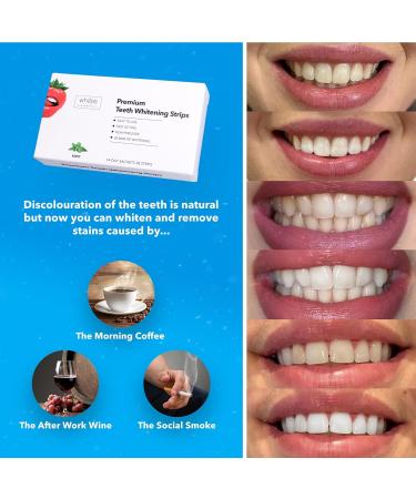 Whites Beaconsfield Teeth Whitening Strips - Non-Peroxide Formula for Sensitive Teeth - 14-Day Supply for Brighter Smile - Buy Online on GoSupps.com