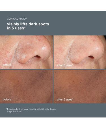 Buy Dermalogica PowerBright Dark Spot Face Peel | Exfoliating 12% AHA PHA for Dark Spots & Hyperpigmentation - All Skin Types - International Shipping - Buy Online on GoSupps.com