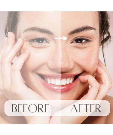 Bot 144 Slutopian Stripes for Non-Surgical Eyelid Lift - Dermatest Verified - Invisible Breathable Technology - 144 Stripes - Buy Online on GoSupps.com