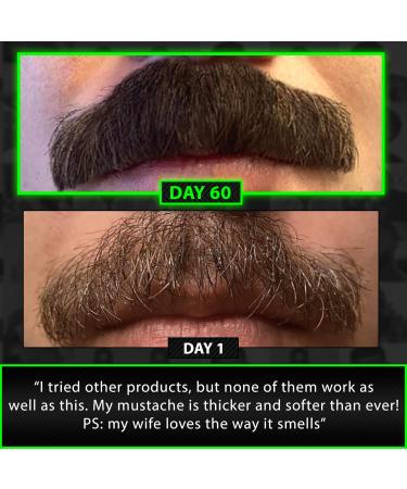 Beard Growth Kit w/ 2X Thickening Biotin Balm & Mustache Wax + Hair Growth Vitamins for Men + Grow XXL Beard Oil for Men + 6X Liquid Biotin with Collagen Peptides - Formulated in America - Buy Online on GoSupps.com