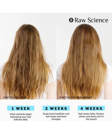 RAW SCIENCE Hair Growth Vitamins for Women & Men - Biotin, Collagen, B7 Gummies for Hair, Nails, Skin - 60ct Hair Growth Supplement for Thicker Stronger Hair - Buy Online on GoSupps.com