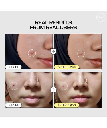 JUMISO Snail Mucin 95% + Peptide Essence | Hydrating Serum for Dry Skin | 4.73 fl. oz | Korean Skincare - Deep Moisturizer & Daily Hydration - Buy Online on GoSupps.com