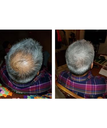 Caboki VALUE PACK 2 (3 x 30 gram plus one Volume Control Mist) 270-Day Supply Salt & Pepper Light - Buy Online on GoSupps.com