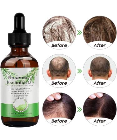  Hogdseirrs Rosemary oil for hair growth and hair loss in men and women rosemary essential oil for skin care pure nature 60 ml - Buy Online on GoSupps.com